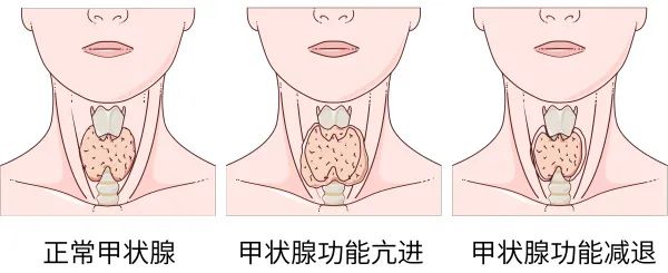 微信图片_20250613093302.jpg 微信图片_20250613093302.jpg