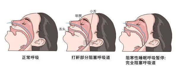 微信图片_20250702093527.jpg 微信图片_20250702093527.jpg
